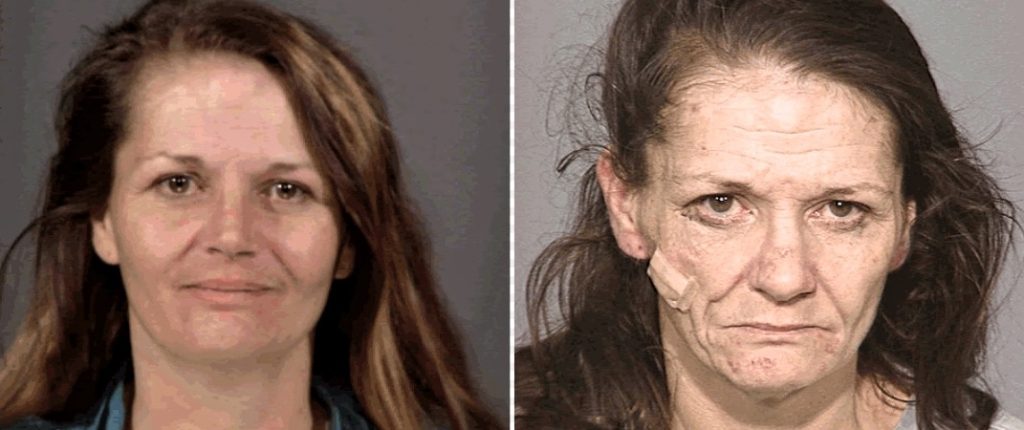 Meth before and after picture