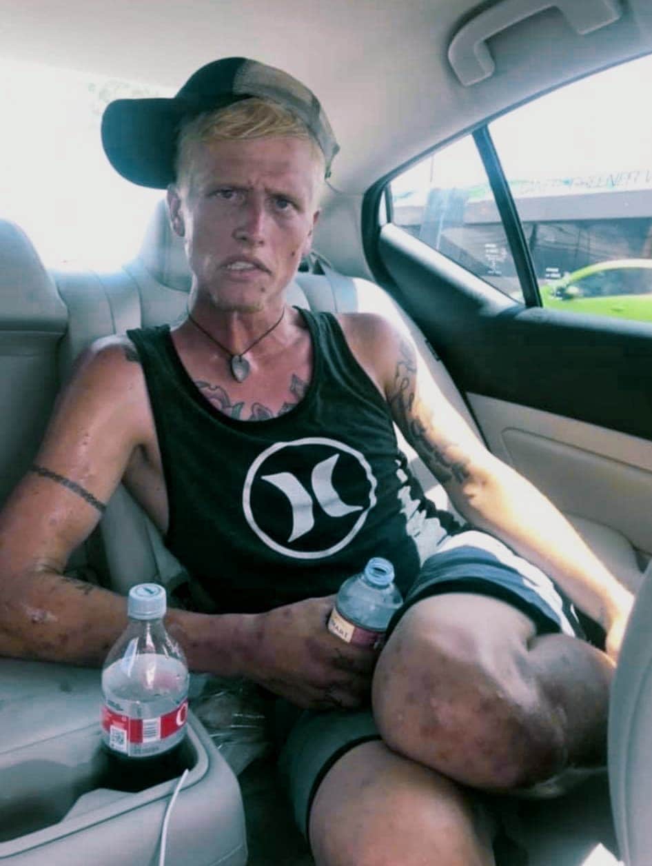 Cody heroin addiction before recovery picture